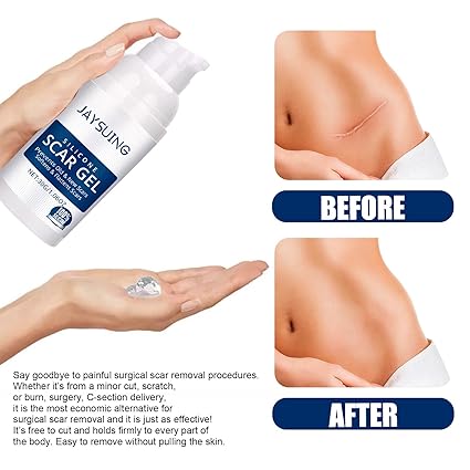 Jaysuing Silicone Scar Gel thumbnail 5