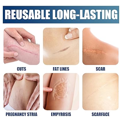 Jaysuing Silicone Scar Gel thumbnail 4