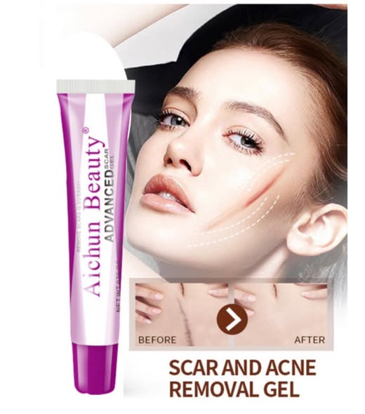 Aichun Beauty Acne Scar Gel Cream thumbnail 3