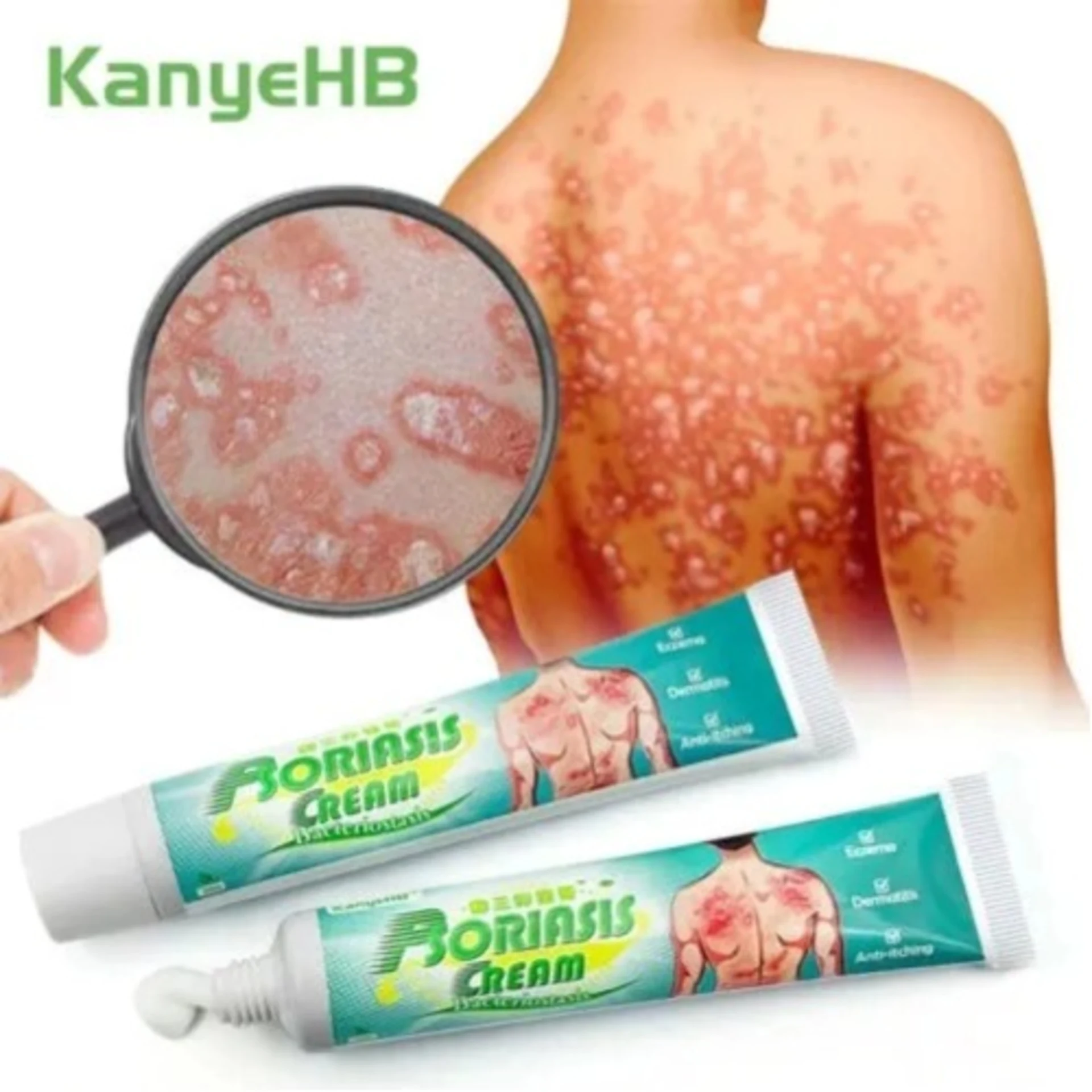Kanyehb Psoriasis Cream thumbnail 4