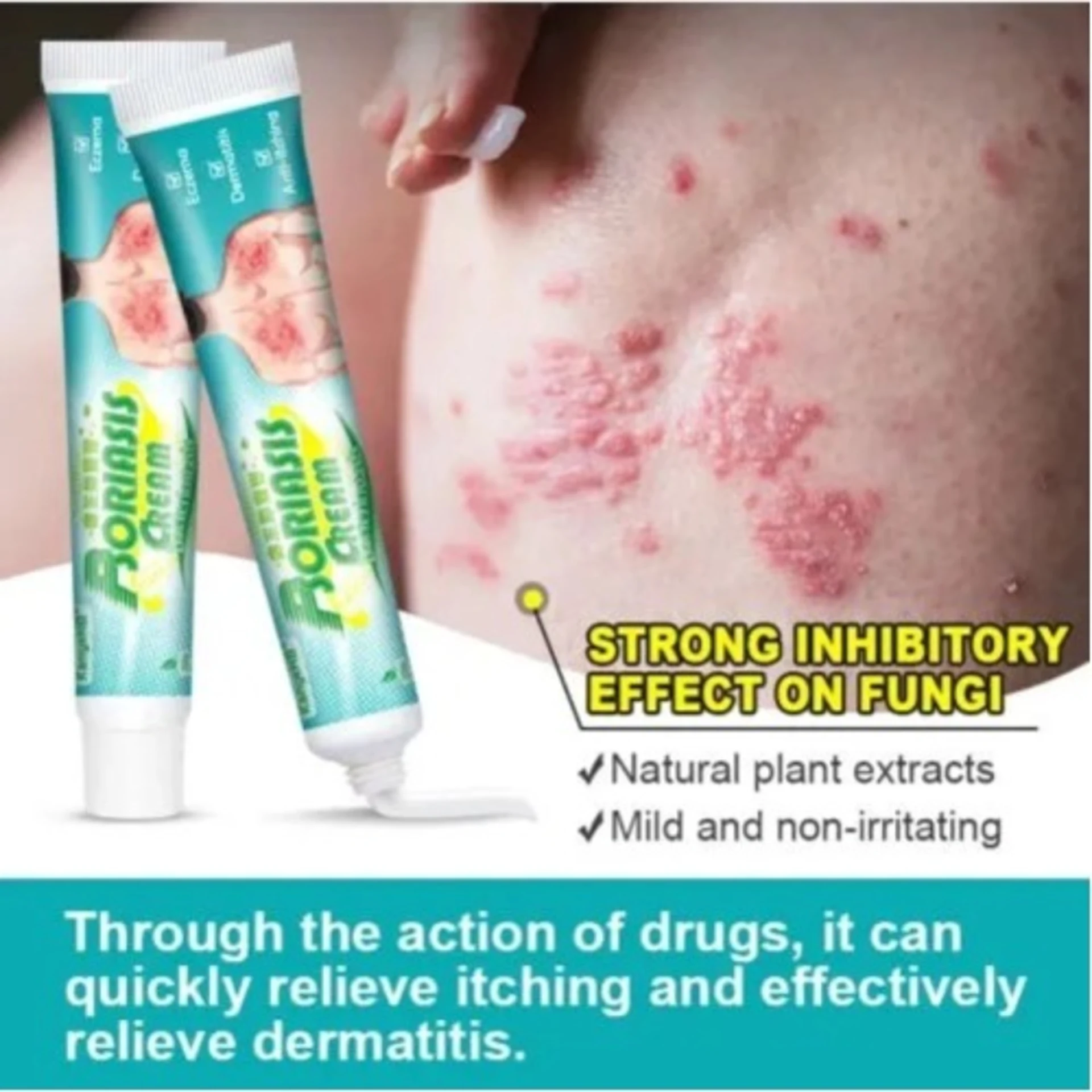 Kanyehb Psoriasis Cream thumbnail 2