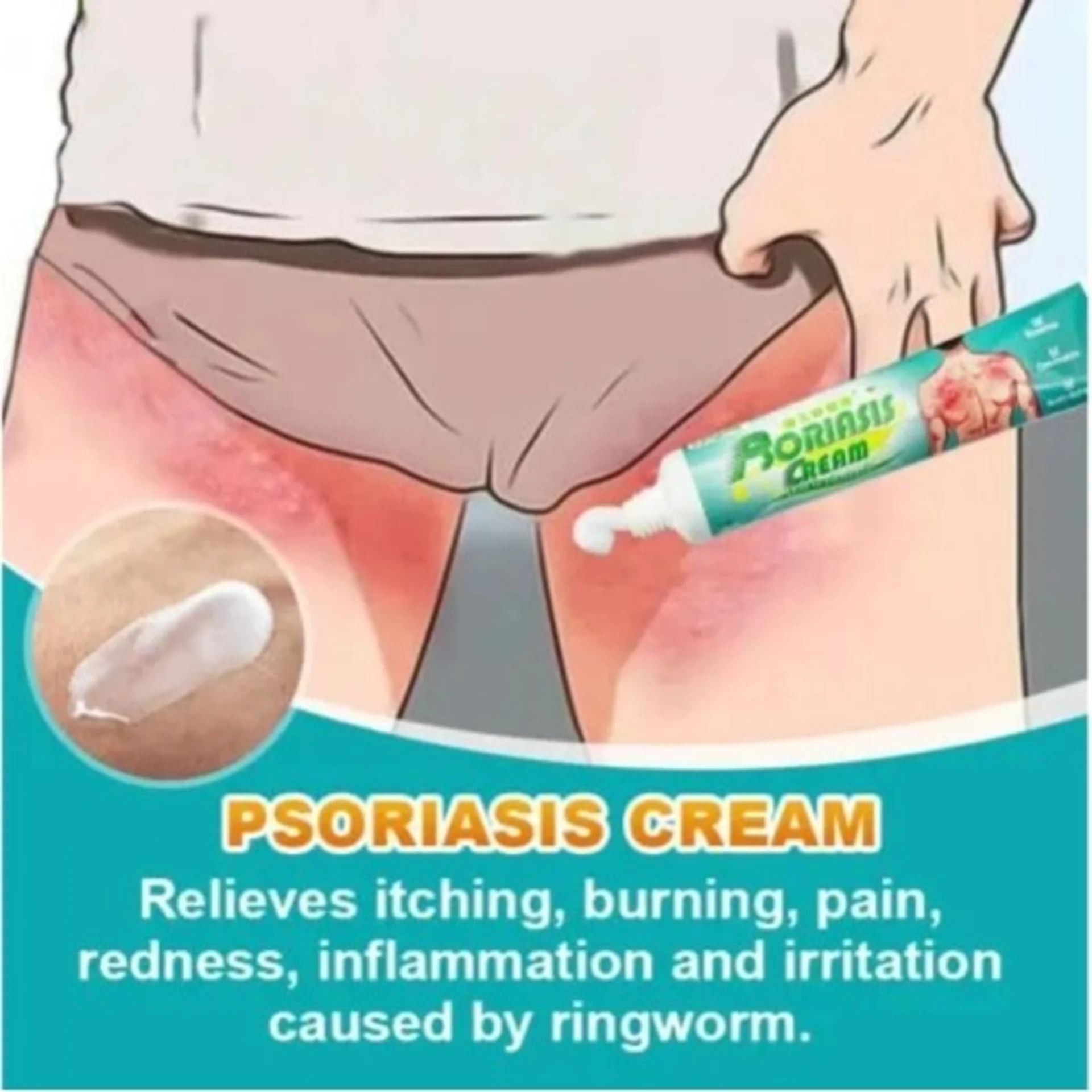 Kanyehb Psoriasis Cream thumbnail 3
