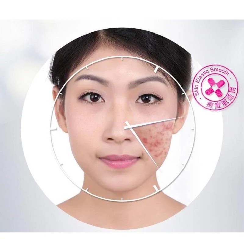 Bioaqua Anti Acne Face Cream for Acne-Prone Skin thumbnail 2
